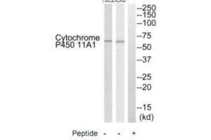 Western Blotting (WB) image for anti-Cytochrome P450, Family 11, Subfamily A, Polypeptide 1 (CYP11A1) (C-Term) antibody (ABIN7180152)