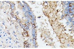 Immunohistochemistry of paraffin-embedded Rat lung using KRT14 Polyclonal Antibody at dilution of 1:100 (40x lens). (KRT14 抗体)