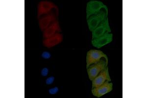 ABIN6257851 and ABIN6275627 staining Hela cells(45 min of heat-shock) by IF/ICC.