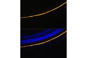 Immunofluorescence analysis of Mouse eye cells using RPE65 antibody (ABIN6130679, ABIN6147090, ABIN6147091 and ABIN6225161) at dilution of 1:100. (RPE65 抗体  (AA 274-533))