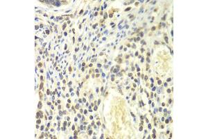 Immunohistochemistry of paraffin-embedded human colon using PSMA4 antibody (ABIN6291447) at dilution of 1:100 (40x lens). (PSMA4 抗体)