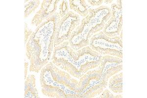 Immunohistochemistry analysis of paraffin-embedded rat small intestine using GBA (ABIN7074062) at dilution of 1: 2000 (GBA 抗体)