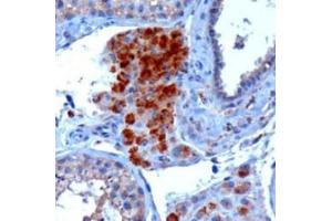 Image no. 1 for anti-SECIS Binding Protein 2 (SECISBP2) (Internal Region) antibody (ABIN374739) (SECISBP2 抗体  (Internal Region))