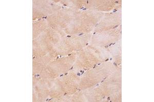 Immunohistochemistry (Paraffin-embedded Sections) (IHC (p)) image for anti-SMAD, Mothers Against DPP Homolog 1 (SMAD1) (AA 20-330) antibody (ABIN6242630)