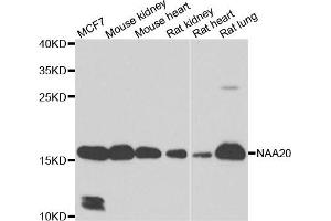 Western blot analysis of extracts of various cell lines, using NAA20 antibody. (NAT5 抗体)