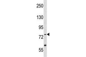 TLK2 antibody western blot analysis in Y79 lysate (TLK2 抗体  (AA 141-171))