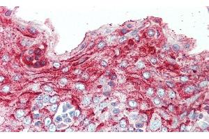 Immunohistochemistry (IHC) image for anti-serine Peptidase Inhibitor, Kazal Type 5 (SPINK5) (AA 699-976) antibody (ABIN7436423)