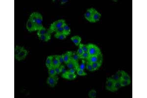 Immunofluorescence staining of HepG2 cells with ABIN7149218 at 1:166, counter-stained with DAPI. (CYP26C1 抗体  (AA 331-460))