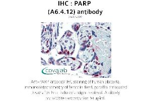 Image no. 1 for anti-Poly (ADP-Ribose) Polymerase 1 (PARP1) antibody (ABIN1723251) (PARP1 抗体)