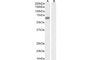 ABIN570957 (0. (SLC47A1 抗体  (Internal Region))