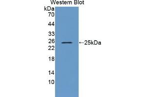Detection of Recombinant TREH, Human using Polyclonal Antibody to Trehalase (TREH) (TREH 抗体  (AA 237-420))