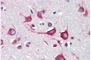 Human Brain, Cortex (formalin-fixed, paraffin-embedded) stained with Cholera Toxin antibody ABIN462099 at 10 ug/ml followed by biotinylated anti-mouse IgG secondary antibody ABIN481714, alkaline phosphatase-streptavidin and chromogen. (Calreticulin 抗体)