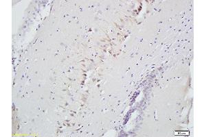 Formalin-fixed and paraffin embedded rat brain labeled with Anti-Slit2/Slil3 Polyclonal Antibody, Unconjugated (ABIN749963) at 1:300 followed by conjugation to the secondary antibody and DAB staining (SLIT2 抗体  (AA 451-550))