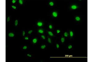 Immunofluorescence of monoclonal antibody to VAV1 on HeLa cell. (VAV1 抗体  (AA 681-790))