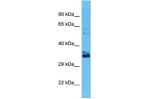 Western Blotting (WB) image for anti-Olfactory Receptor, Family 2, Subfamily W, Member 1-Like (OR2W3) (C-Term) antibody (ABIN2791730) (OR2W3 抗体  (C-Term))