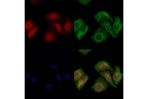 ABIN6266065 and ABIN6278212 staining Hela cells by IF/ICC. (XPO4 抗体  (N-Term))