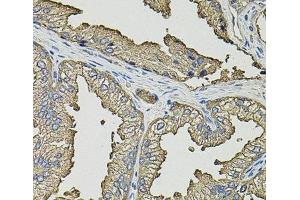 Immunohistochemistry of paraffin-embedded Human prostate using SMN2 Polyclonal Antibody (SMN2 抗体)