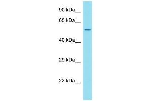 Host: Rabbit Target Name: ANKRD34C Sample Type: OVCAR-3 Whole Cell lysates Antibody Dilution: 1. (ANKRD34C 抗体  (N-Term))