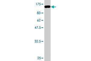 Western Blot detection against Immunogen (93. (PRC1 抗体  (AA 1-620))