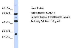 Host: Rabbit Target Name: KLHL41 Sample Type: Fetal Muscle lysates Antibody Dilution: 1. (Kelch-like protein 41 (KLHL41) (Middle Region) 抗体)