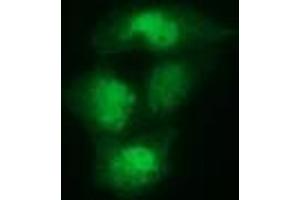 Anti-SPR mouse monoclonal antibody (ABIN2453681) immunofluorescent staining of COS7 cells transiently transfected by pCMV6-ENTRY SPR (RC205679). (SPR 抗体)