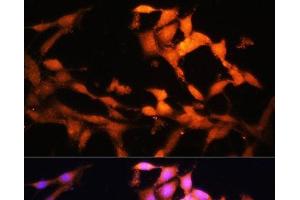 Immunofluorescence analysis of NIH/3T3 cells using FLCN Polyclonal Antibody at dilution of 1:100. (FLCN 抗体)