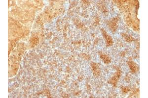 Formalin-fixed, paraffin-embedded human Salivary Tumor stained with Cytochrome C Monoclonal Antibody (SPM389). (Cytochrome C 抗体  (AA 1-80))