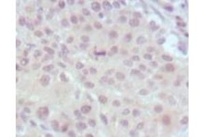 Immunohistochemistry (IHC) image for anti-Myeloid/lymphoid Or Mixed-Lineage Leukemia (MLL) (AA 3751-3968) antibody (ABIN2464083) (MLL/KMT2A 抗体  (AA 3751-3968))