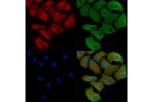 Phospho-IFNAR1 (Tyr466) Antibody staining Hela cells(heat shock treatment) by IF/ICC. (IFNAR1 抗体  (pTyr466))