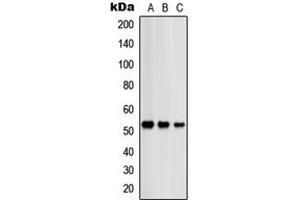Western blot analysis of PRKAR2B expression in HeLa (A), SHSY5Y (B), NIH3T3 (C) whole cell lysates. (PRKAR2B 抗体  (Center))