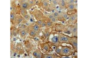 Used in DAB staining on fromalin fixed paraffin-embedded Liver tissue (PNLIP 抗体  (AA 201-412))