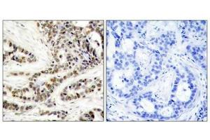Immunohistochemistry (IHC) image for anti-cAMP Responsive Element Binding Protein 1 (CREB1) (pSer129) antibody (ABIN7138418)
