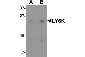 Western blot analysis of LY6K in HeLa cell lysate with LY6K antibody at (A) 1 and (B) 2 µg/mL. (Ly6k 抗体  (N-Term))