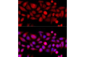 Immunofluorescence (IF) image for anti-Kinesin Family Member 4A (KIF4A) (AA 870-1080) antibody (ABIN6142873)