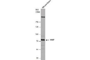 WB Image HHIP antibody [N3C2], Internal detects HHIP protein by western blot analysis. (HHIP 抗体)