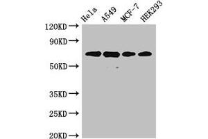 Western Blot Positive WB detected in: Hela whole cell lysate, A549 whole cell lysate, MCF-7 whole cell lysate, HEK293 whole cell lysate All lanes: XRCC6 antibody at 4 μg/mL Secondary Goat polyclonal to rabbit IgG at 1/50000 dilution Predicted band size: 70, 66 kDa Observed band size: 70 kDa (XRCC6 抗体  (AA 2-609))