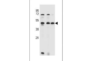 ANKRD40 Antibody (C-term) (ABIN655309 and ABIN2844891) western blot analysis in 293,HL-60,MCF-7 cell line lysates (35 μg/lane). (ANKRD40 抗体  (C-Term))