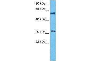 Host:  Mouse  Target Name:  NFIA  Sample Tissue:  Mouse Testis  Antibody Dilution:  1ug/ml (NFIA 抗体  (Middle Region))