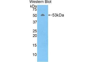 Western Blotting (WB) image for anti-Fibrous Sheath Interacting Protein 1 (FSIP1) (AA 109-328) antibody (ABIN1858923) (FSIP1 抗体  (AA 109-328))
