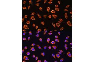 Immunofluorescence analysis of L929 cells using NOTCH4 Rabbit pAb (ABIN6132420, ABIN6144740, ABIN6144741 and ABIN6224315) at dilution of 1:100. (NOTCH4 抗体  (AA 1824-2003))