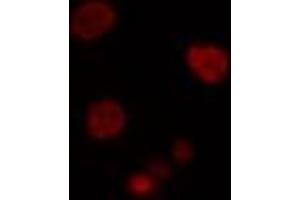 ABIN6274502 staining Hela cells by IF/ICC. (PBOV1 抗体  (Internal Region))