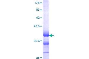 Image no. 1 for Calcitonin-Related Polypeptide alpha (CALCA) (AA 52-141) protein (GST tag) (ABIN1347867)