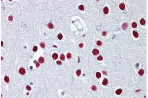 Anti-TUB antibody IHC staining of human brain, cortex. (TUB 抗体  (AA 144-193))