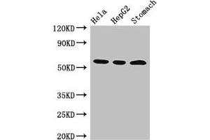 Western Blot Positive WB detected in: Hela whole cell lysate, HepG2 whole cell lysate, Mouse stomach tissue All lanes: MDM4 antibody at 3 μg/mL Secondary Goat polyclonal to rabbit IgG at 1/50000 dilution Predicted band size: 55, 15, 14, 19, 50 kDa Observed band size: 55 kDa (MDM4-binding Protein 抗体  (AA 208-306))