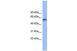 Image no. 1 for anti-Interleukin 18 Receptor 1 (IL18R1) (AA 35-84) antibody (ABIN6743248) (IL18R1 抗体  (AA 35-84))