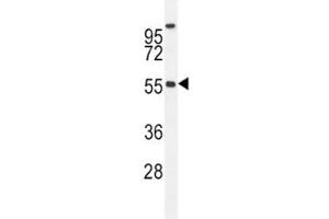 BMP4 antibody western blot analysis in MDA-MB435 lysate. (BMP4 抗体  (AA 5-34))