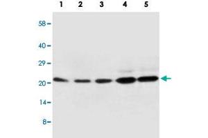 Western blot analysis of tissue and whole cell extracts with CDC42 polyclonal antibody . (CDC42 抗体  (Internal Region))