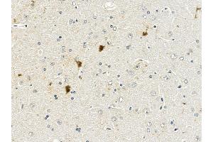 APP Mouse Monoclonal Antibody at 1/100 staining rat brain tissue by IHC-P. (APP 抗体  (C-Term))