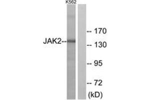 Western blot analysis of extracts from K562 cells, using JAK2 (Ab-221) Antibody. (JAK2 抗体  (AA 191-240))