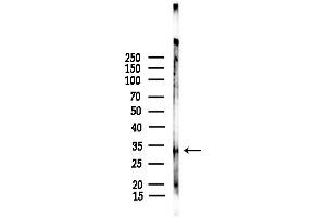 anti-Opioid Receptor, delta 1 (OPRD1) (C-Term) antibody